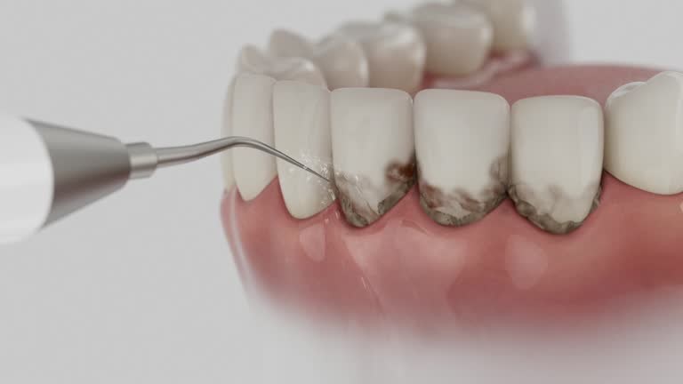 Trusted Teeth Cleaning And Checkup service in Frankfort, MI - Dentist Open Now
